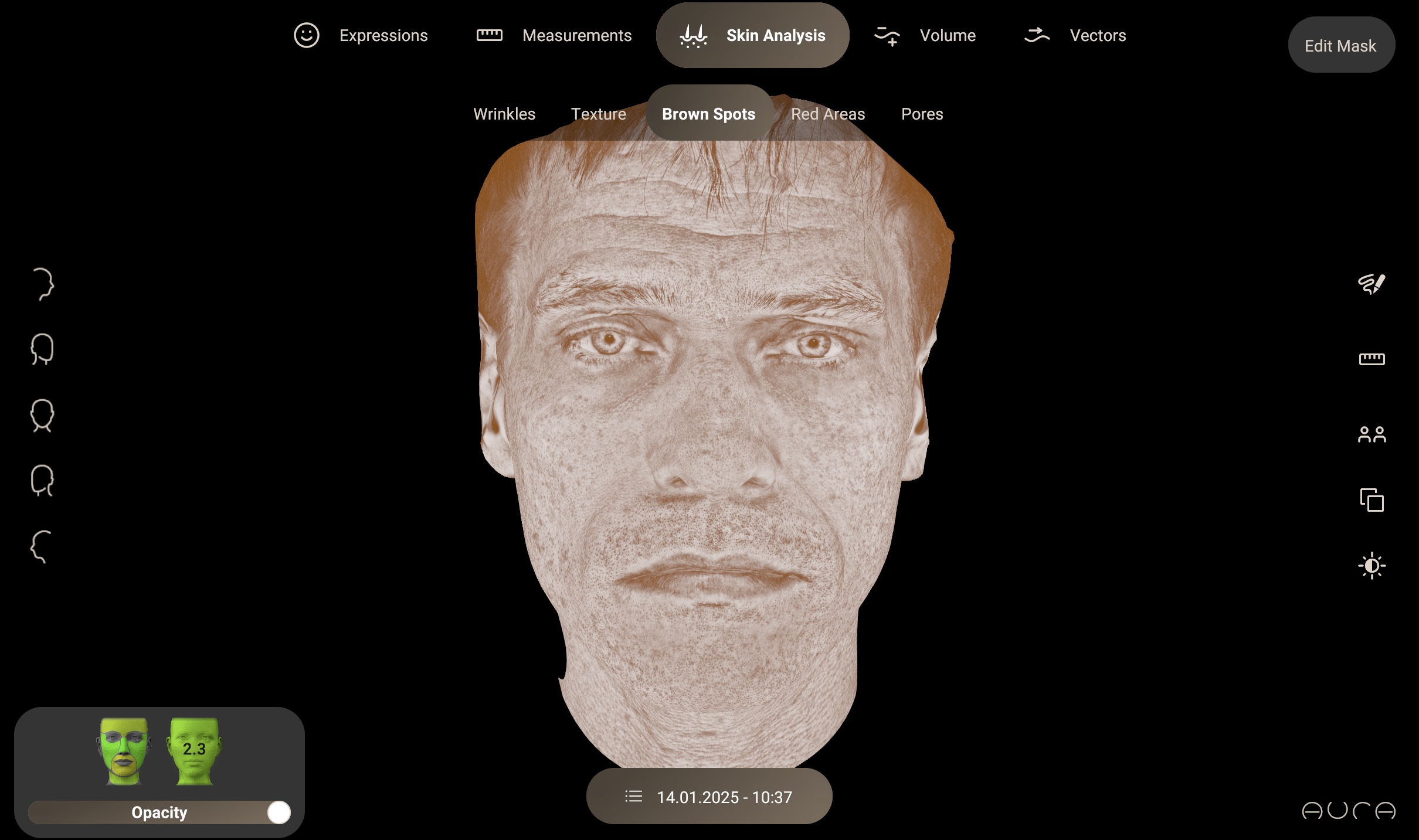 Análisis de las manchas de la piel con Aura 3D