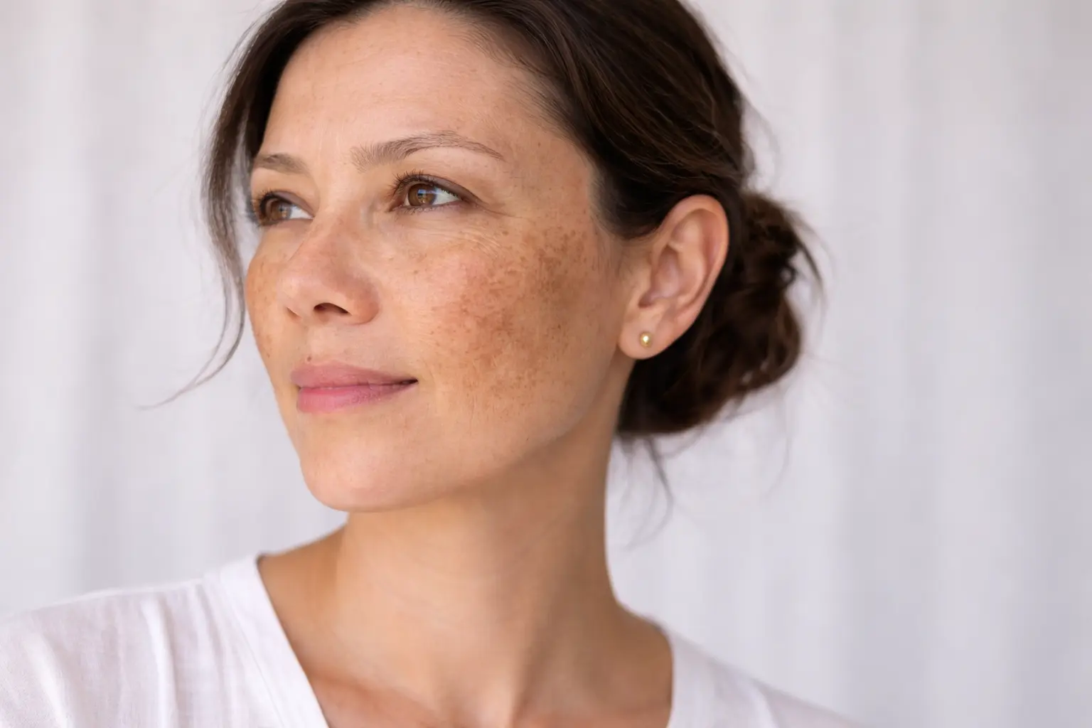 woman melasma skin